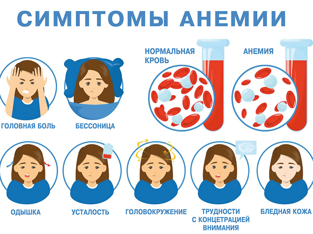 Почему женщинам трудно усваивать железо: основные причины и рекомендации